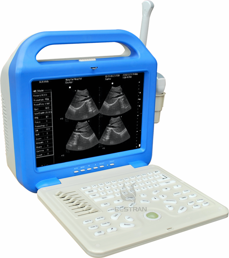 Digital Laptop Ultrasonic  Diagnosis  Equipment