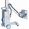 Mobile X-ray Equipment