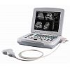 B/W laptop ultrasound machine