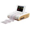 Fetal  Monitor