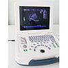 B/W laptop ultrasound machine