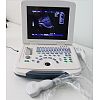 B/W laptop ultrasound machine