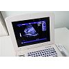 B/W laptop ultrasound machine