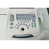 B/W laptop ultrasound machine