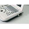 B/W laptop ultrasound machine