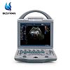 Full Digital Color Doppler Ultrasound scanner（Human)