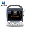 Full Digital Color Doppler Ultrasound Scanner Machine 